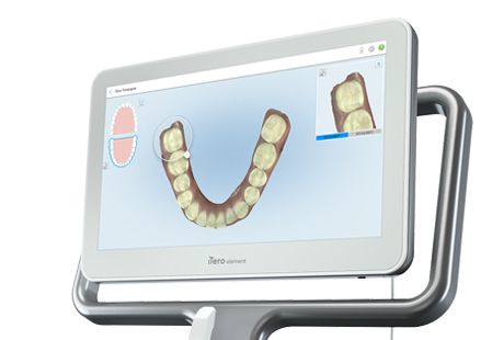 口腔内スキャナー iTero Element 2