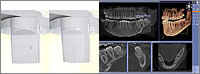 歯科用CTの優れた特徴