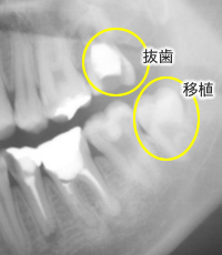 歯が痛い、腫れている、ぐらぐらしている