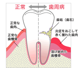 歯が痛い、腫れている、ぐらぐらしている